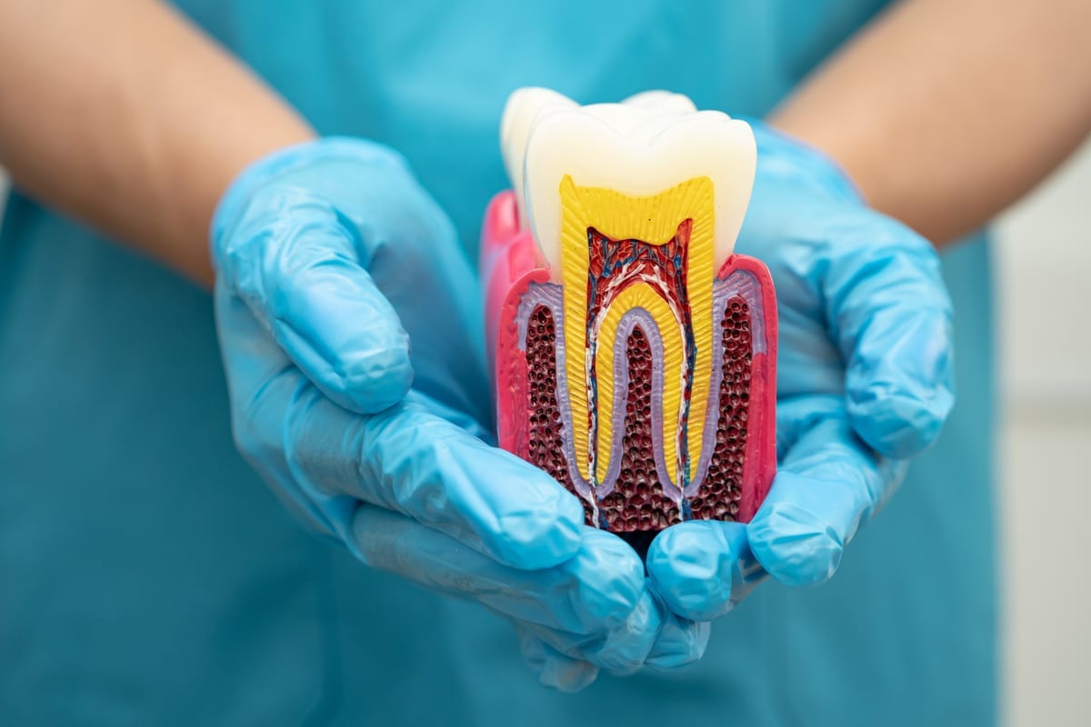 Root Canal Treatment in Edmonton