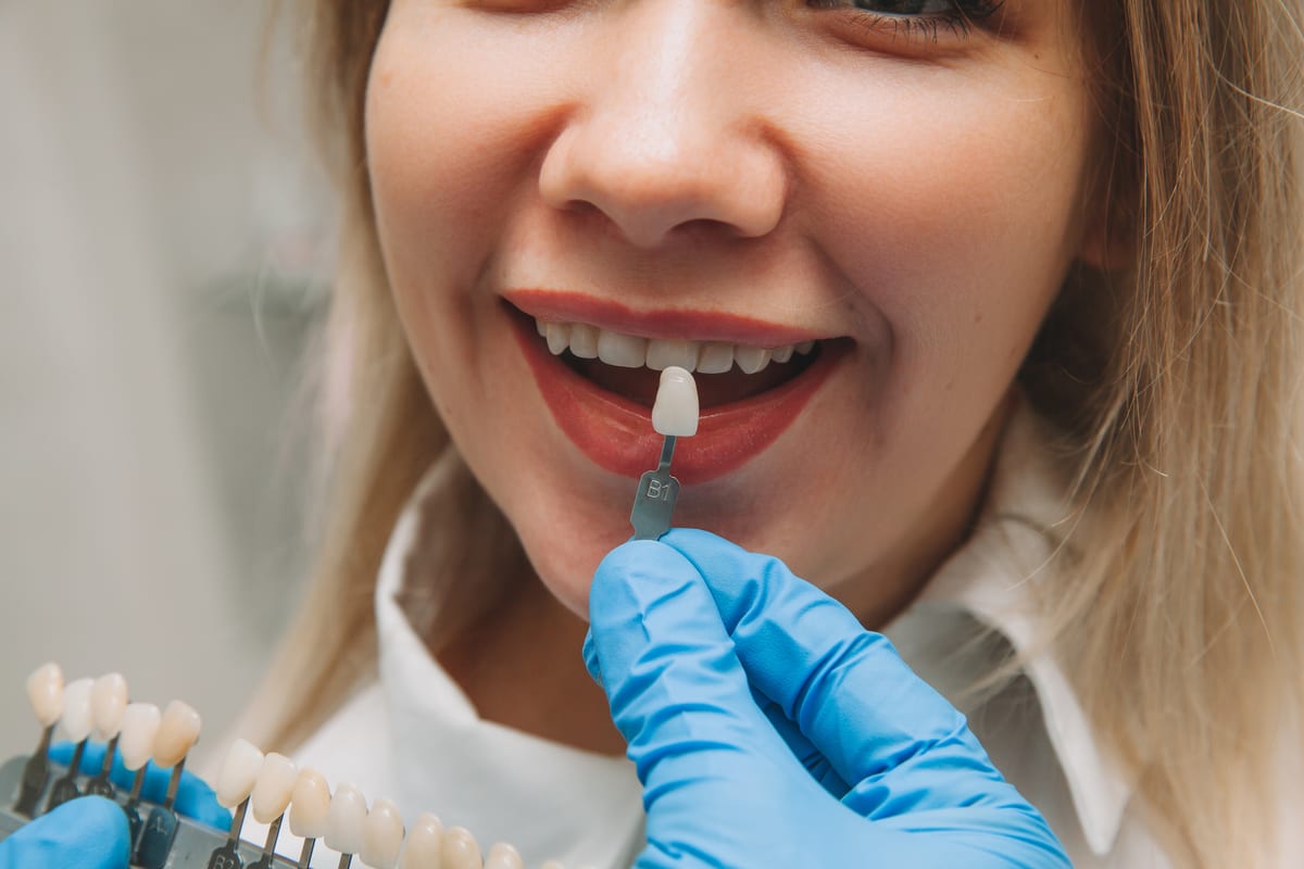 Veneers in Edmonton